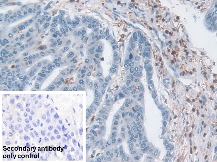 Polyclonal Antibody to L-Plastin (LCP1)