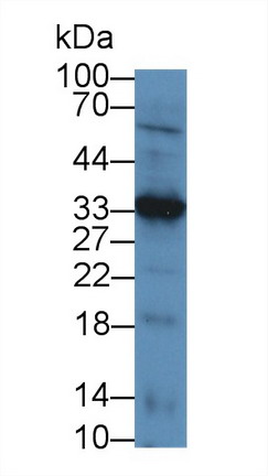 Polyclonal Antibody to Leukocyte Cell Derived Chemotaxin 1 (LECT1)