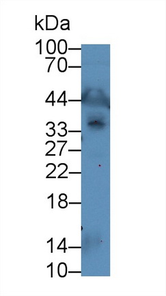 Polyclonal Antibody to Leukocyte Cell Derived Chemotaxin 1 (LECT1)