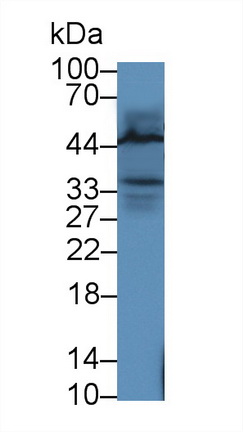 Polyclonal Antibody to Leukocyte Cell Derived Chemotaxin 1 (LECT1)