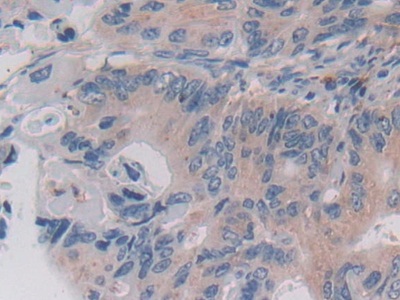 Polyclonal Antibody to Legumain (LGMN)