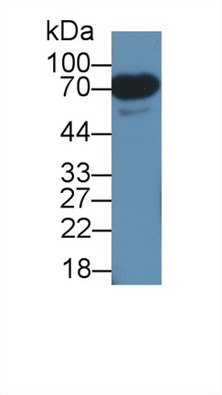 Polyclonal Antibody to Eukaryotic translation initiation factor 2D (EIF2D)