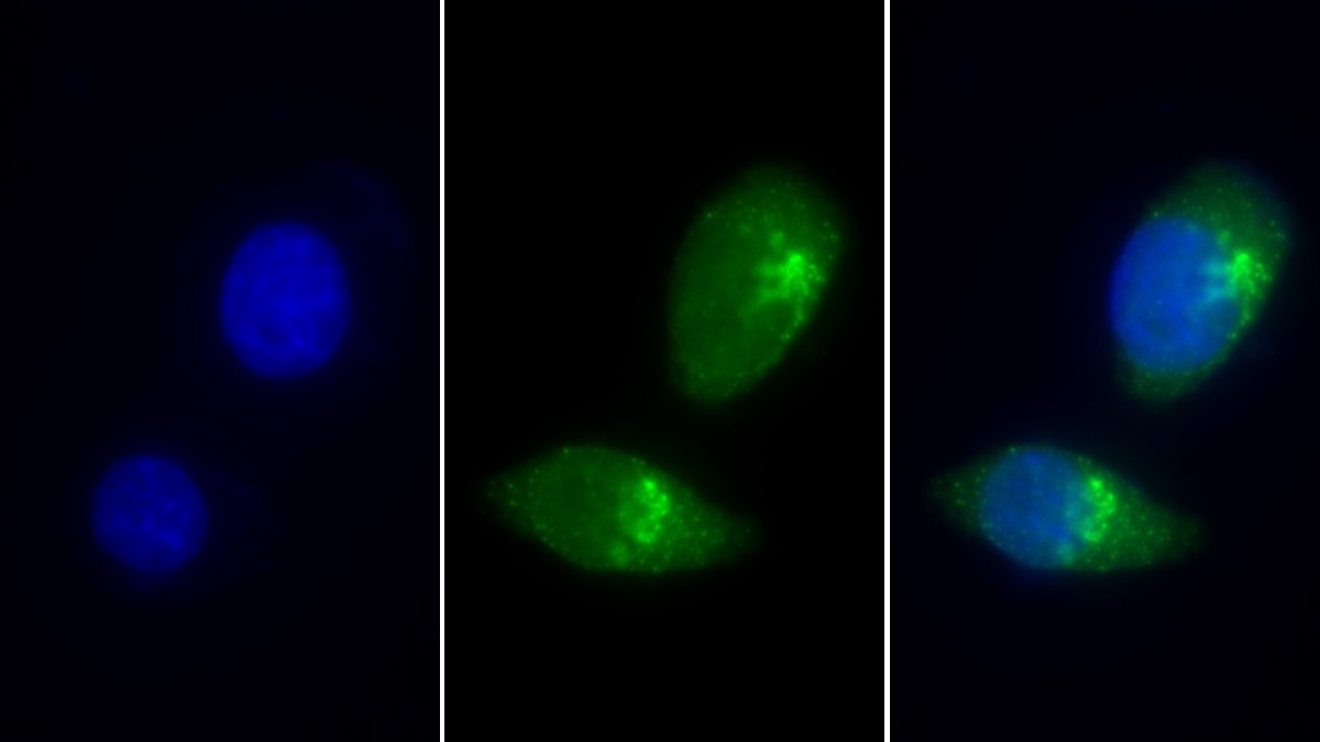 Polyclonal Antibody to Lectin, Mannose Binding 1 (LMAN1)