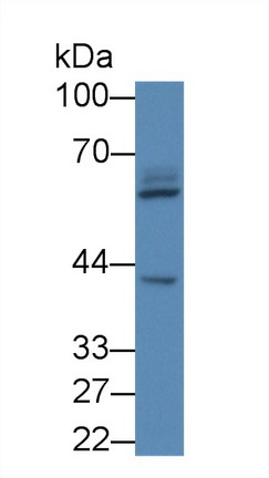 Polyclonal Antibody to Leucine Rich Repeats And Death Domain Containing Protein (LRDD)