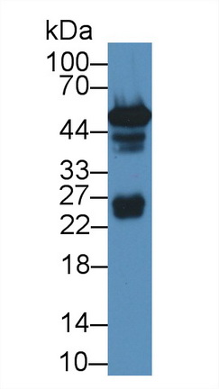 Polyclonal Antibody to Lymphocyte Specific Protein 1 (LSP1)