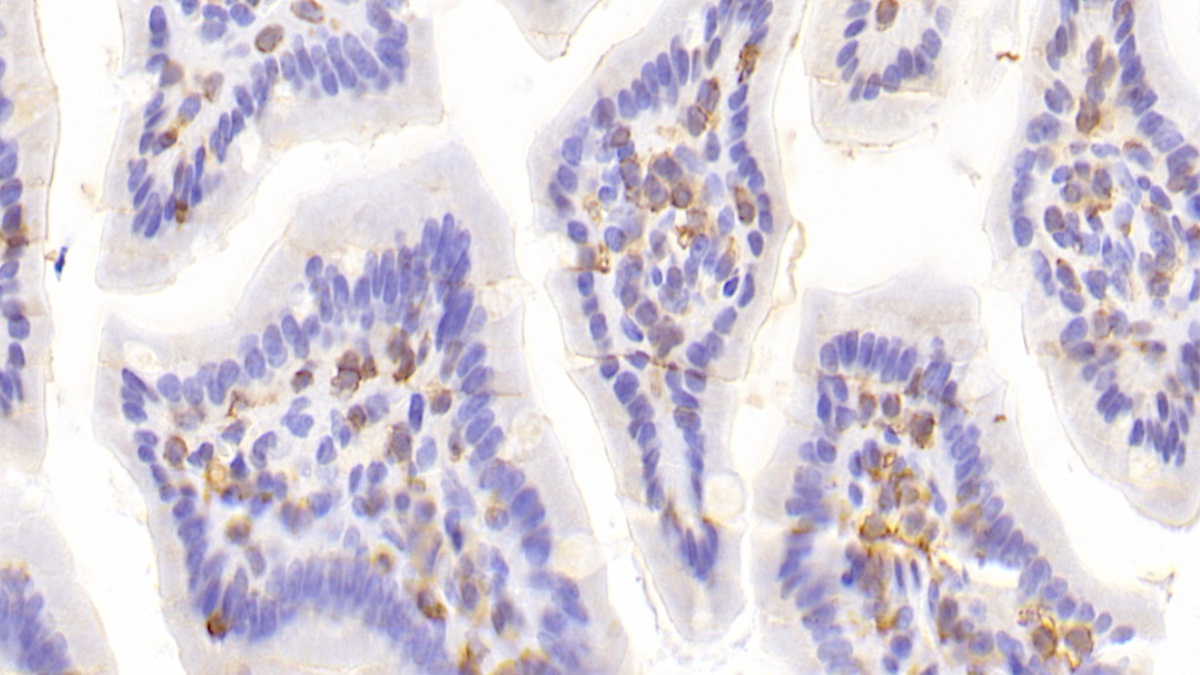 Polyclonal Antibody to Lymphocyte Specific Protein 1 (LSP1)