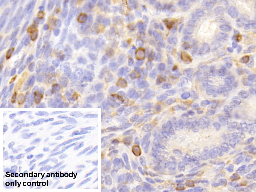 Polyclonal Antibody to Lymphocyte Specific Protein 1 (LSP1)