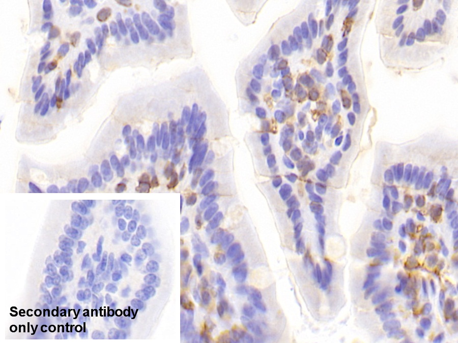 Polyclonal Antibody to Lymphocyte Specific Protein 1 (LSP1)