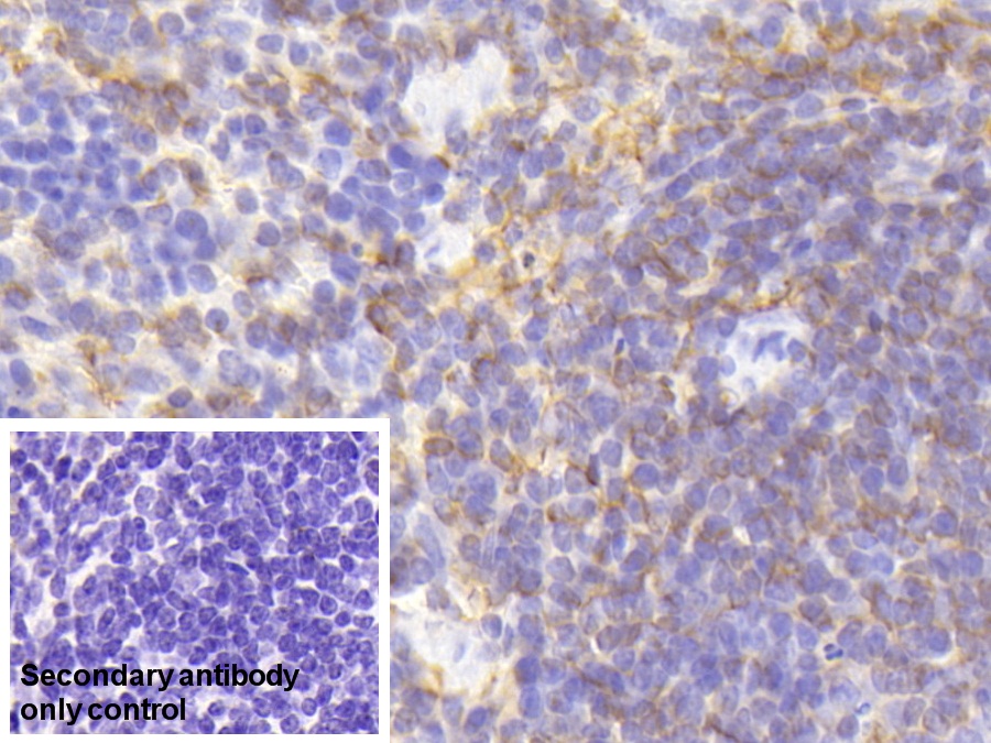 Polyclonal Antibody to Lymphocyte Specific Protein 1 (LSP1)