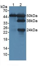 Polyclonal Antibody to Lymphocyte Specific Protein 1 (LSP1)