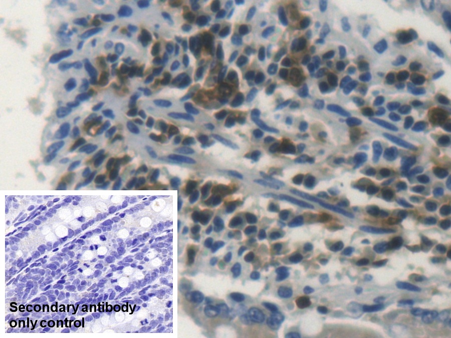 Polyclonal Antibody to Lymphocyte Specific Protein 1 (LSP1)