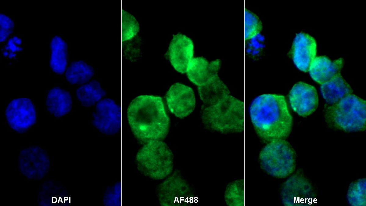 Polyclonal Antibody to Pim-1 Oncogene (PIM1)