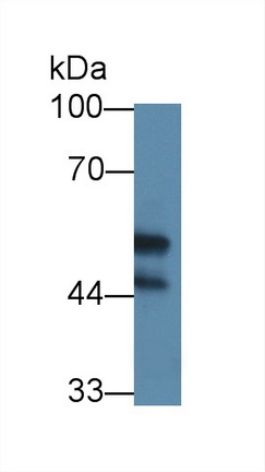 Polyclonal Antibody to Lysyl Oxidase (LOX)