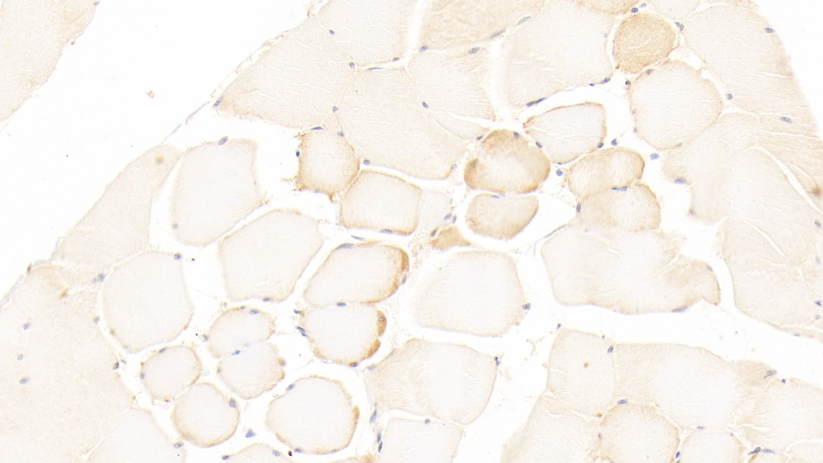 Polyclonal Antibody to Lysyl Oxidase (LOX)