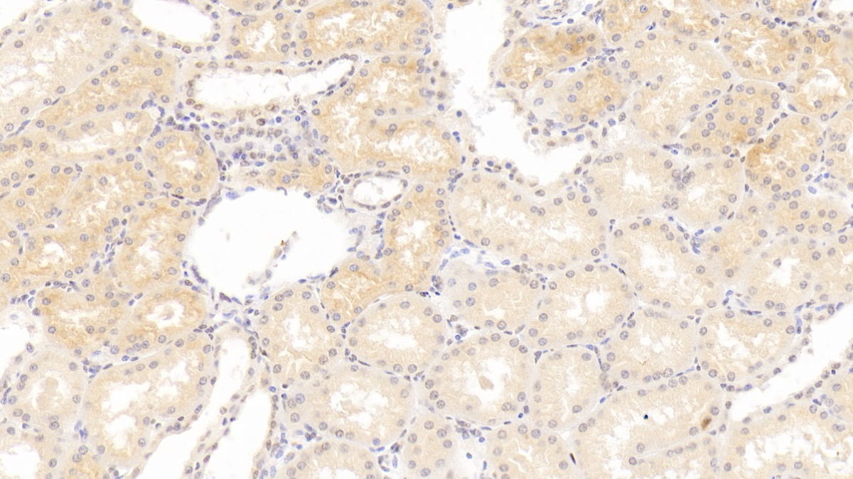 Polyclonal Antibody to Lysyl Oxidase (LOX)