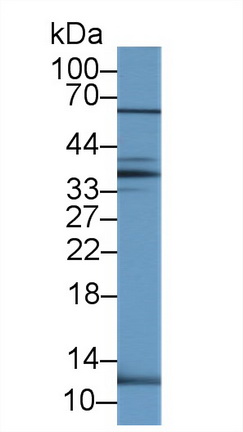 Polyclonal Antibody to Urocortin 2 (UCN2)