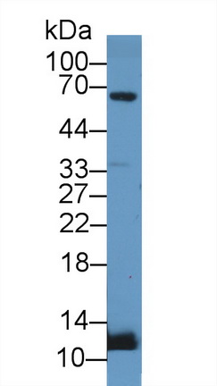 Polyclonal Antibody to Urocortin 2 (UCN2)