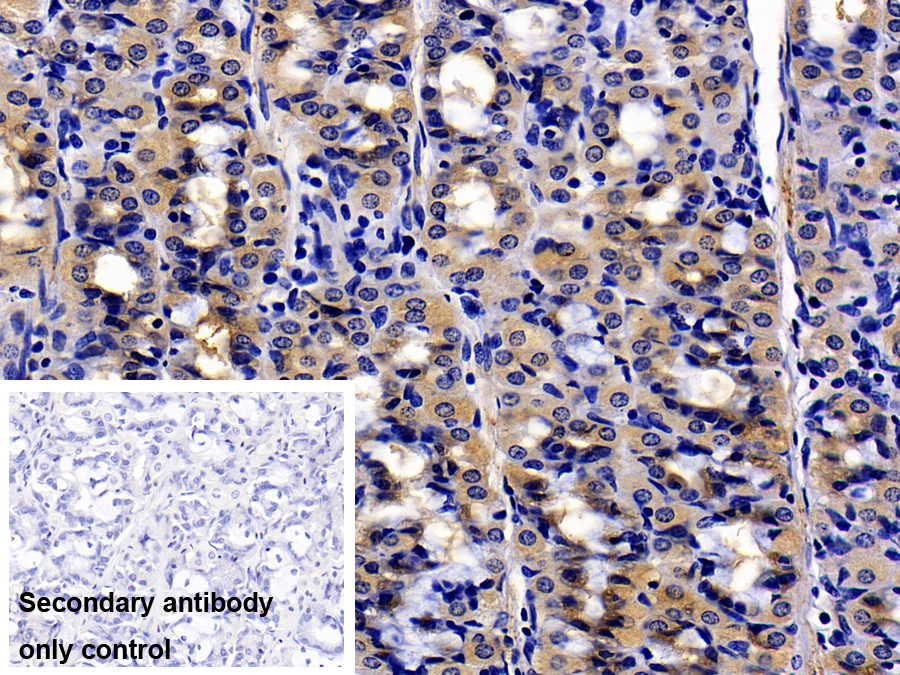 Polyclonal Antibody to Urocortin 2 (UCN2)