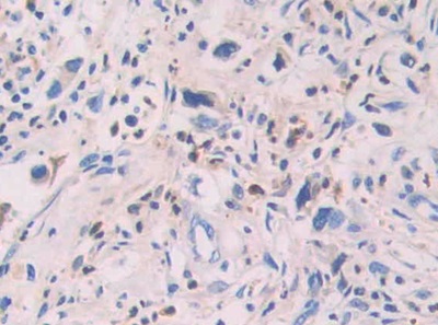 Polyclonal Antibody to Mitochondrial Uncoupling Protein 2 (UCP2)