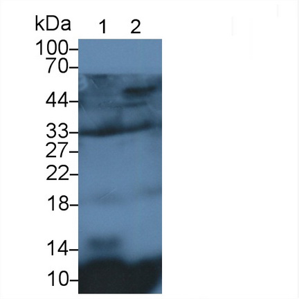 Polyclonal Antibody to Mitochondrial Uncoupling Protein 2 (UCP2)