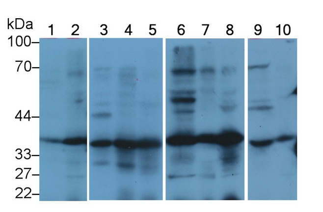 Polyclonal Antibody to Mitochondrial Uncoupling Protein 2 (UCP2)