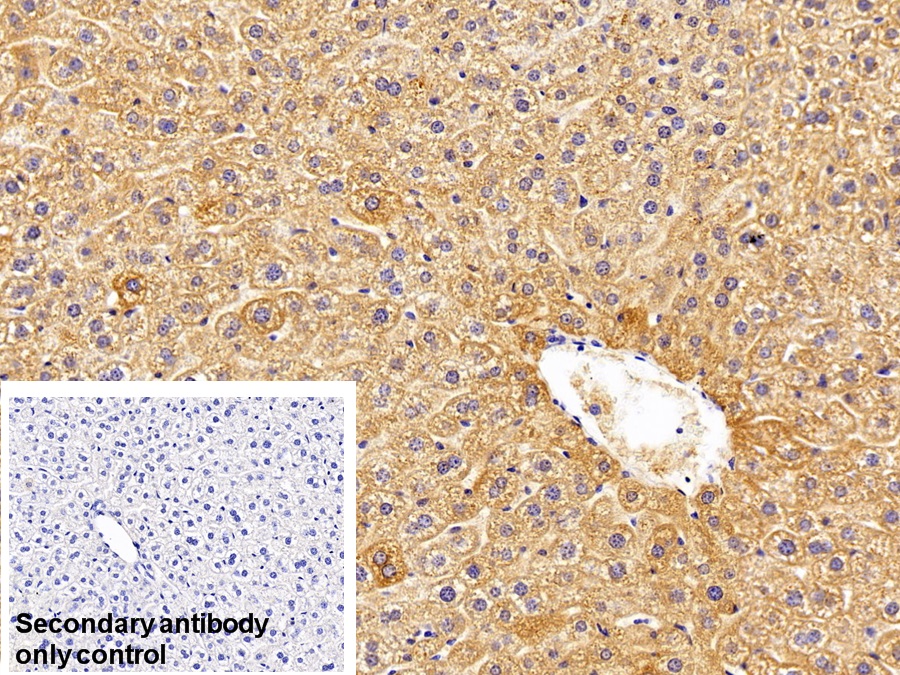 Polyclonal Antibody to Mitochondrial Uncoupling Protein 2 (UCP2)