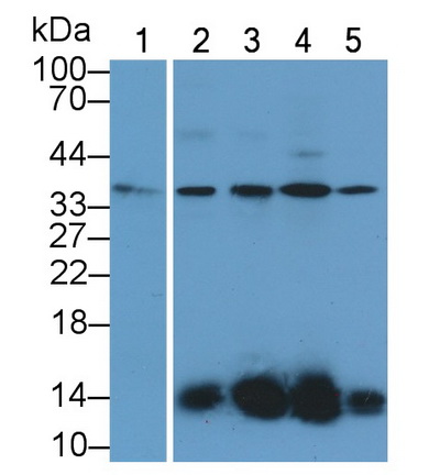 Polyclonal Antibody to Mitochondrial Uncoupling Protein 2 (UCP2)