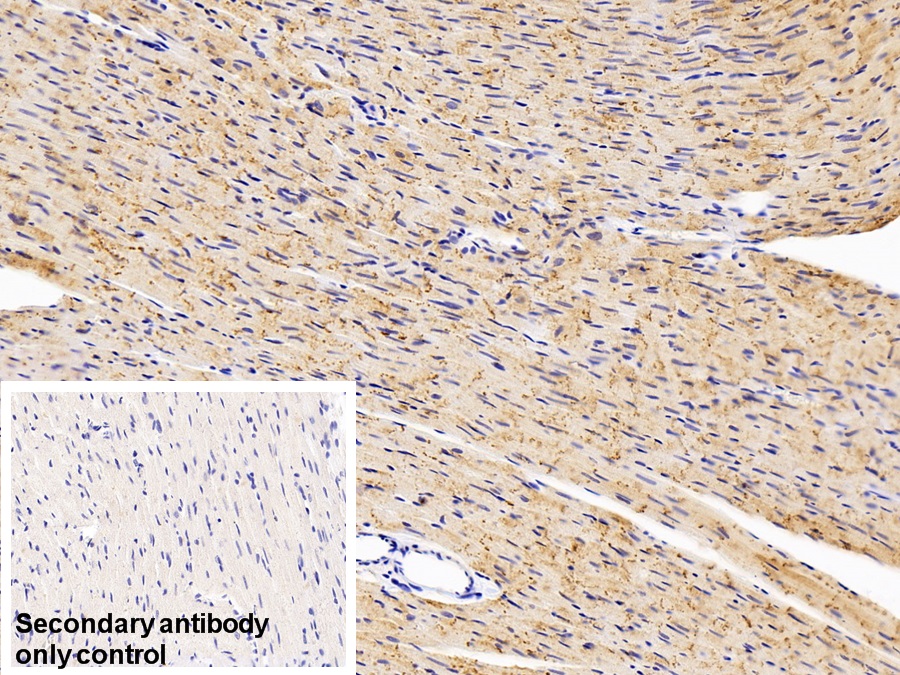 Polyclonal Antibody to Mitochondrial Uncoupling Protein 2 (UCP2)