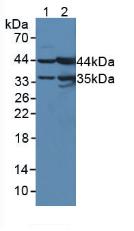 Polyclonal Antibody to Beta-ureidopropionase (UPB1)