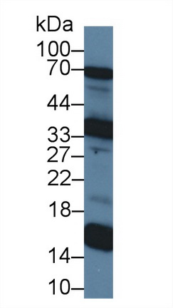 Polyclonal Antibody to Ubiquinol Cytochrome C Reductase Binding Protein (UQCRB)