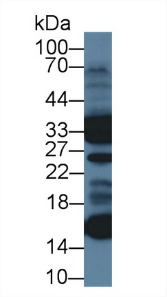 Polyclonal Antibody to Ubiquinol Cytochrome C Reductase Binding Protein (UQCRB)