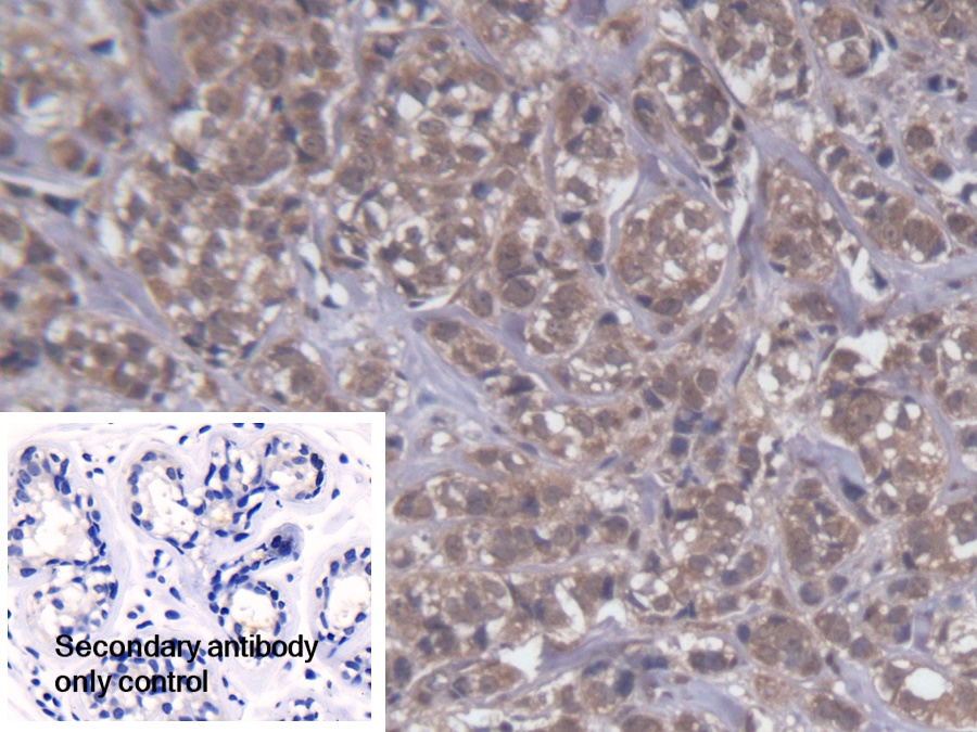 Polyclonal Antibody to Ubiquinol Cytochrome C Reductase Binding Protein (UQCRB)