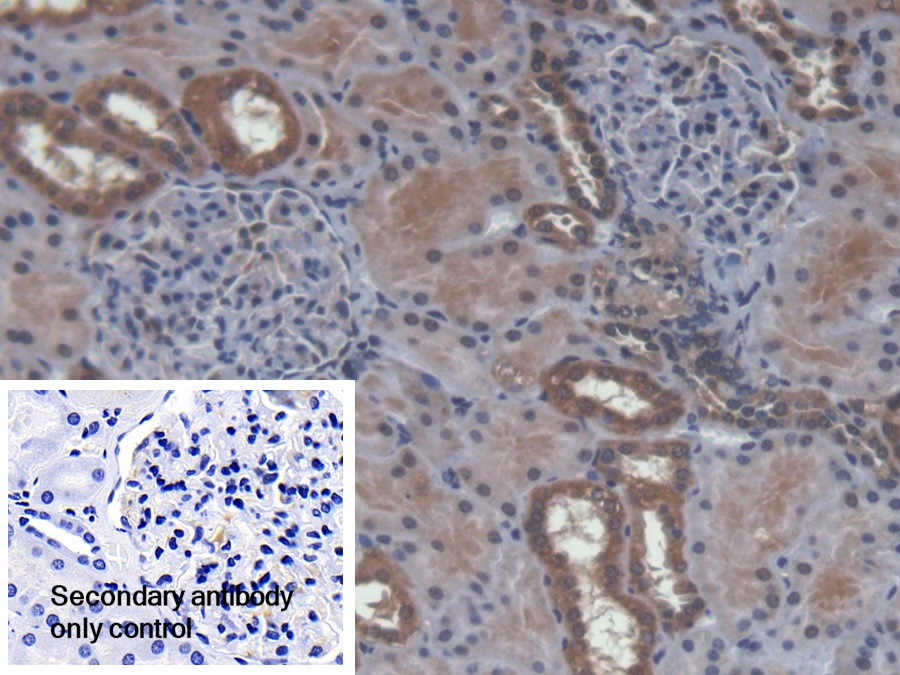 Polyclonal Antibody to Ubiquinol Cytochrome C Reductase Binding Protein (UQCRB)