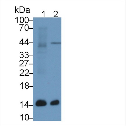 Polyclonal Antibody to Ubiquinol Cytochrome C Reductase Binding Protein (UQCRB)