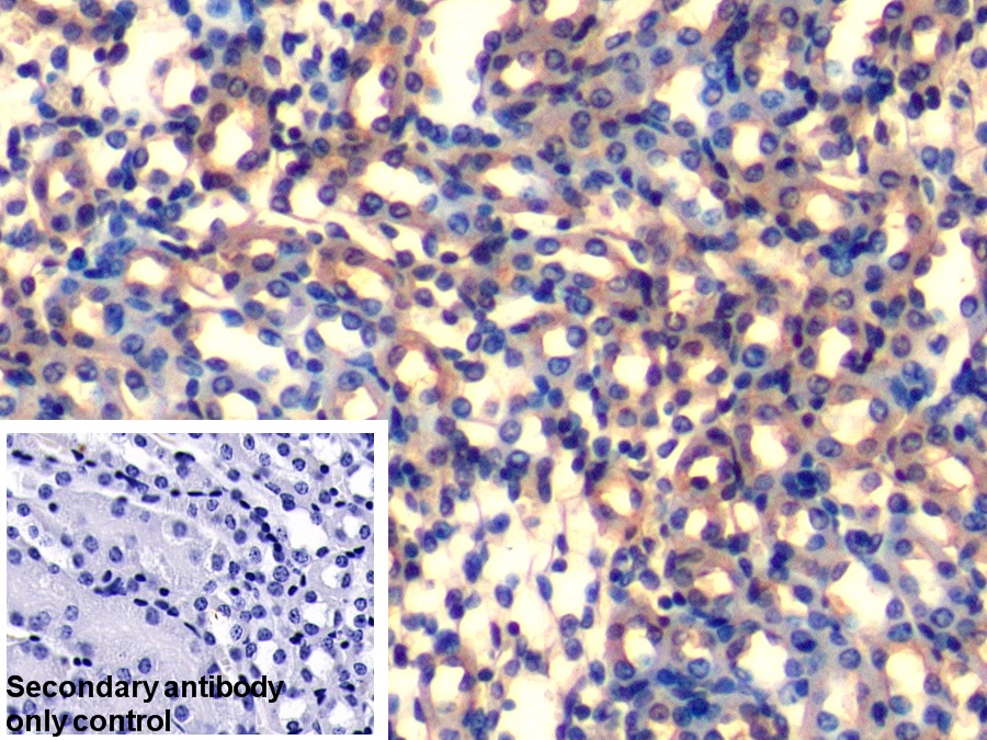 Polyclonal Antibody to Ubiquinol Cytochrome C Reductase Binding Protein (UQCRB)