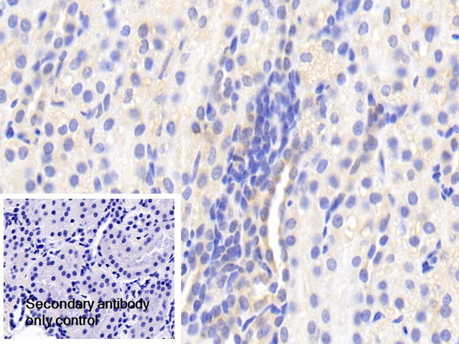 Polyclonal Antibody to Uridine Monophosphate Synthetase (UMPS)