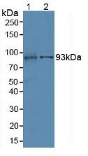 Polyclonal Antibody to Villin (VIL)