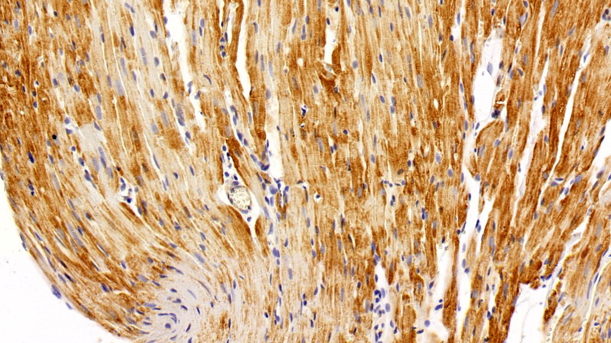 Polyclonal Antibody to Virus Induced Signaling Adapter (VISA)