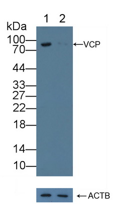 Polyclonal Antibody to Valosin Containing Protein (VCP)