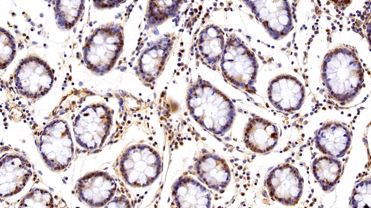 Polyclonal Antibody to Valosin Containing Protein (VCP)