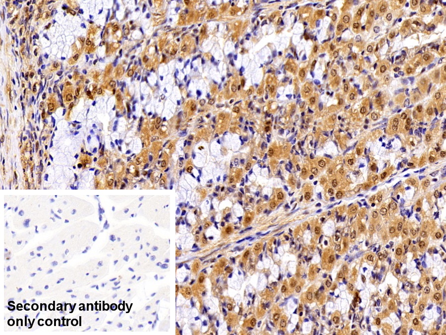 Polyclonal Antibody to Valosin Containing Protein (VCP)