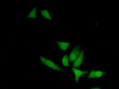 Polyclonal Antibody to X-linked Inhibitor Of Apoptosis Protein (XIAP)