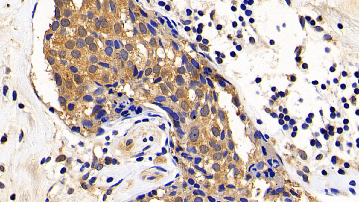 Polyclonal Antibody to X-linked Inhibitor Of Apoptosis Protein (XIAP)