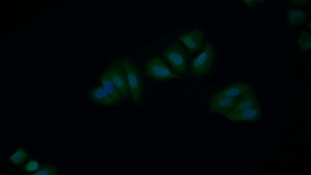 Polyclonal Antibody to X-linked Inhibitor Of Apoptosis Protein (XIAP)