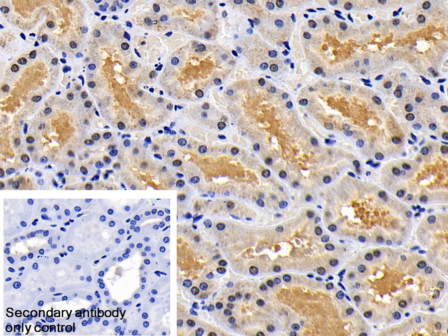 Polyclonal Antibody to X-linked Inhibitor Of Apoptosis Protein (XIAP)