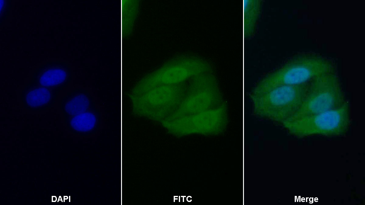 Polyclonal Antibody to X-linked Inhibitor Of Apoptosis Protein (XIAP)