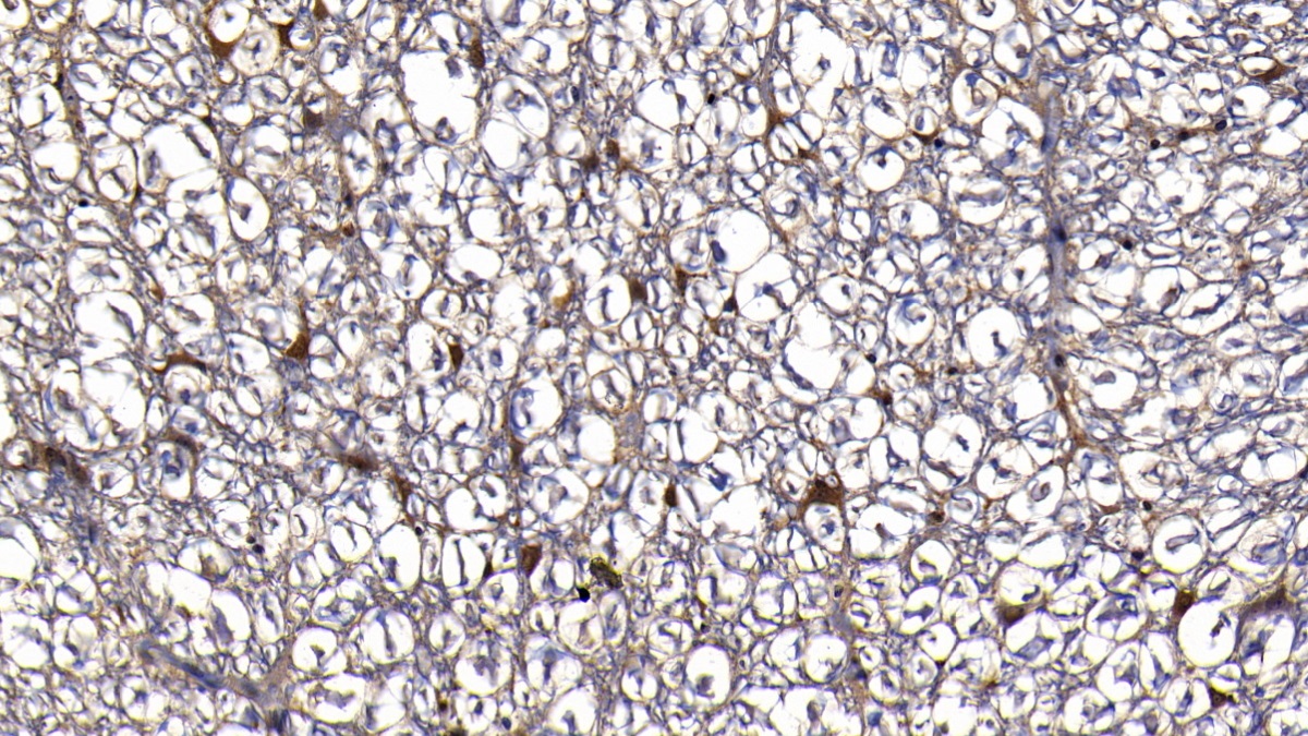 Polyclonal Antibody to Y-Box Binding Protein 1 (YBX1)