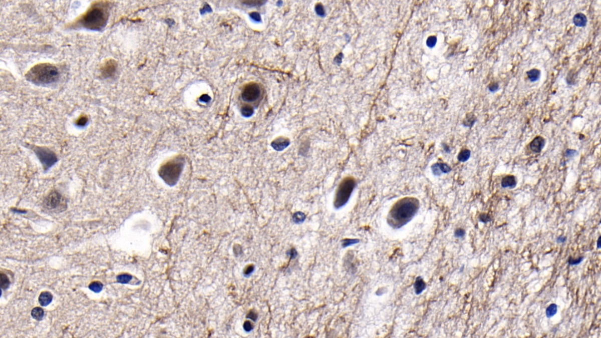 Polyclonal Antibody to Y-Box Binding Protein 1 (YBX1)