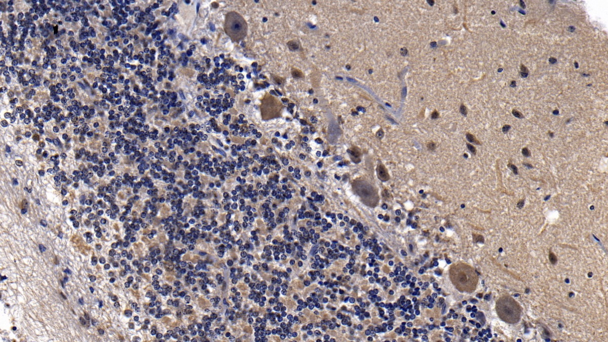 Polyclonal Antibody to Y-Box Binding Protein 1 (YBX1)