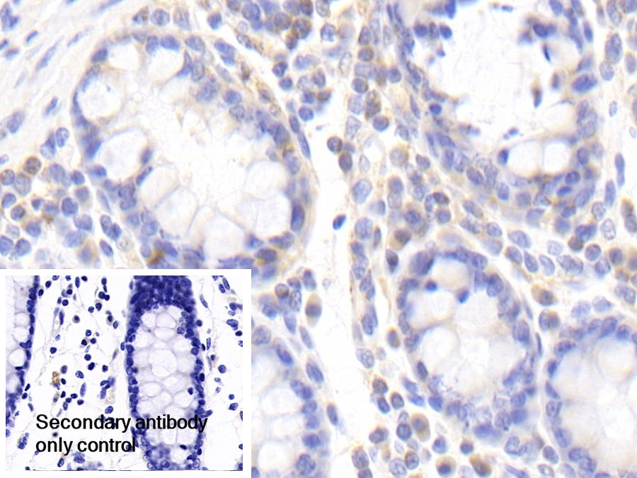 Polyclonal Antibody to Zuotin Related Factor 1 (ZRF1)